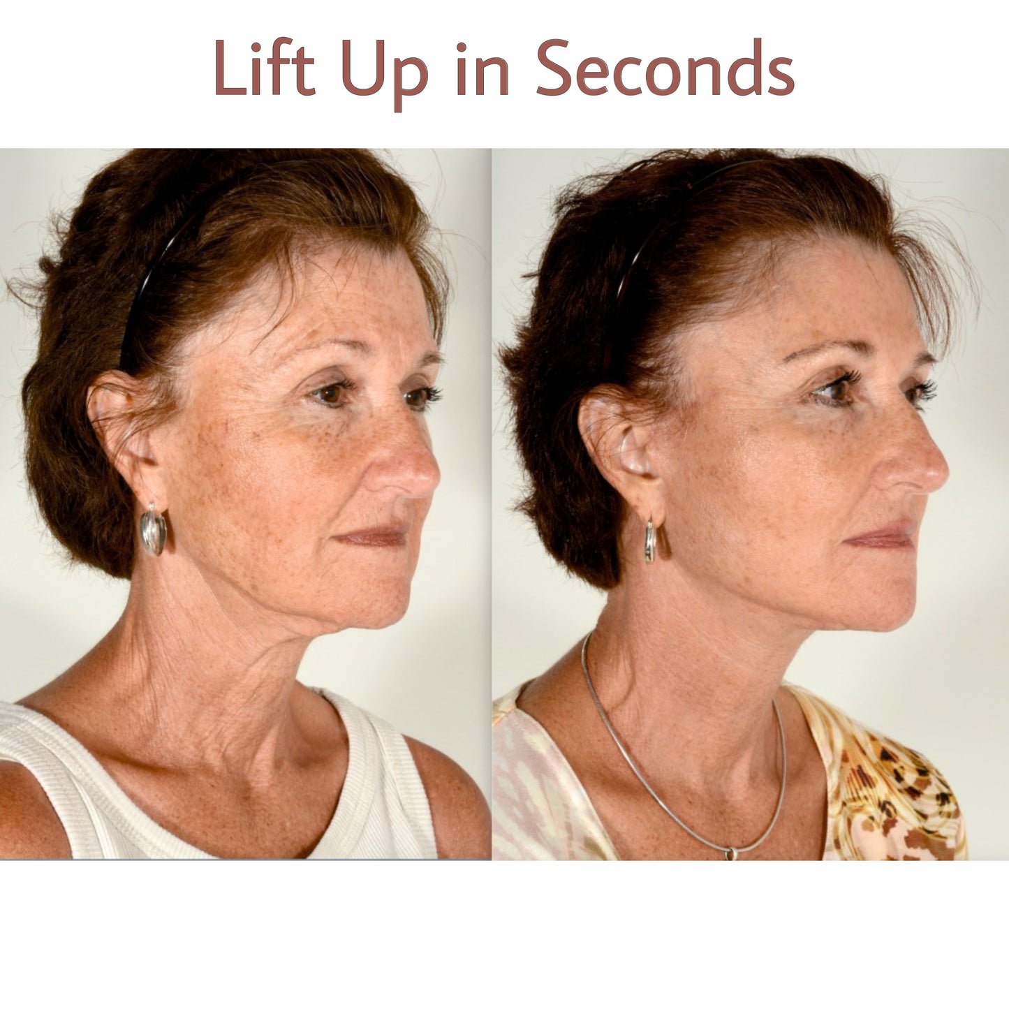 Cerelax V-Edge Patches™