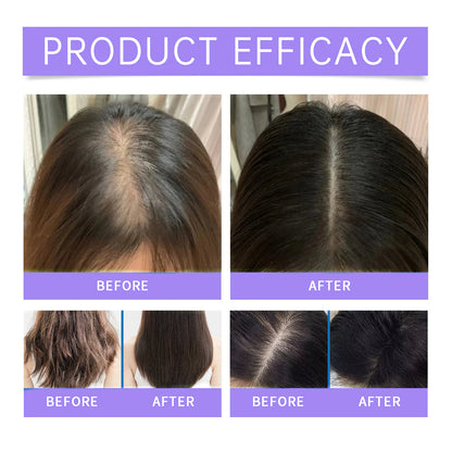 Hair Growth Roll-On Serum