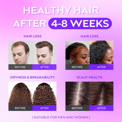 Hair Growth Roll-On Serum