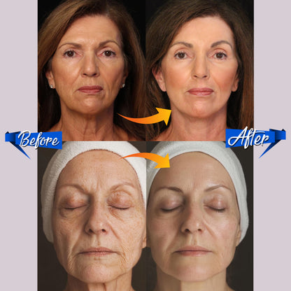 K-Beauty Anti-Wrinkle Patches Kit