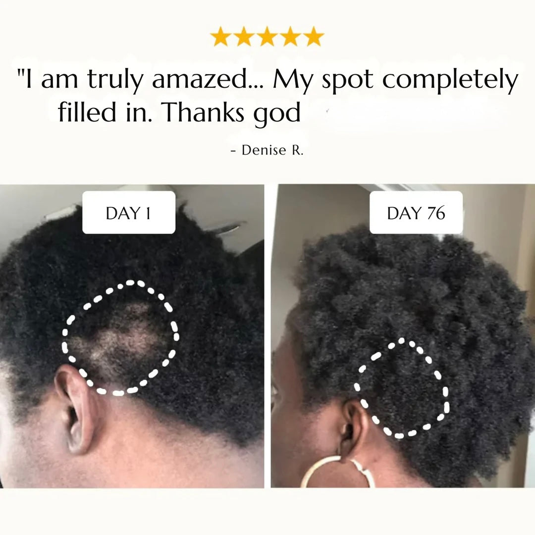 Hair Growth Roll-On Serum