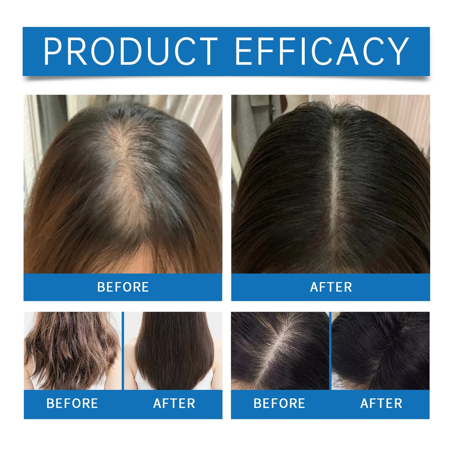Cerelax™ Hair Growth Roll-On Serum